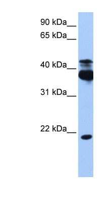 Western Blot: STK38 Antibody [NBP1-58362]