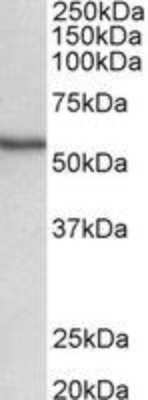 Western Blot: STK38 Antibody [NBP2-27552]