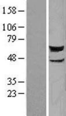 Western Blot: STK38 Overexpression Lysate [NBL1-16552]