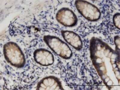 Immunohistochemistry-Paraffin: STK38L Antibody (4E5) [H00023012-M01]