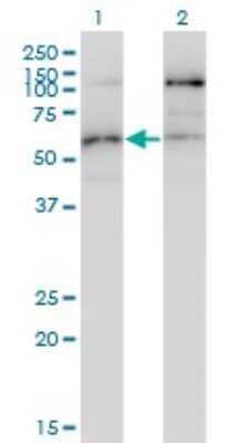 Western Blot: STK38L Antibody (4E5) [H00023012-M01]