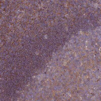Immunohistochemistry-Paraffin: STK38L Antibody [NBP1-92454]