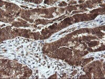 Immunohistochemistry: STK38L Antibody (OTI4D8) - Azide and BSA Free [NBP2-74403]