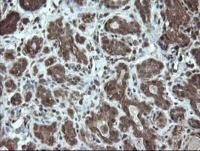 Immunohistochemistry: STK38L Antibody (OTI4D8) - Azide and BSA Free [NBP2-74403]