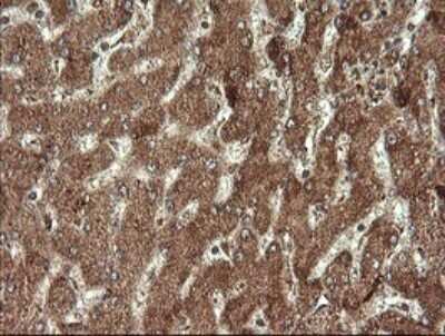 Immunohistochemistry: STK38L Antibody (OTI4D8) - Azide and BSA Free [NBP2-74403]