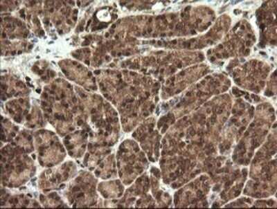 Immunohistochemistry: STK38L Antibody (OTI4D8) - Azide and BSA Free [NBP2-74403]