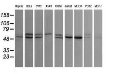 Western Blot: STK38L Antibody (OTI4D8)Azide and BSA Free [NBP2-74403]