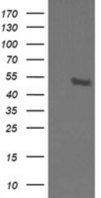 Western Blot: STK38L Antibody (OTI4D8)Azide and BSA Free [NBP2-74403]