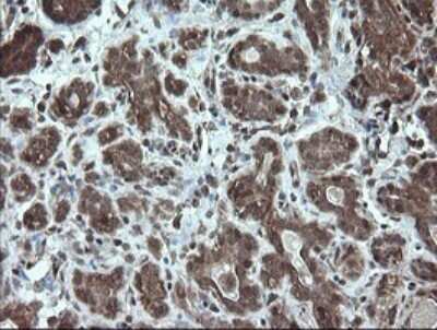 Immunohistochemistry: STK38L Antibody (OTI4D8) [NBP2-45983]