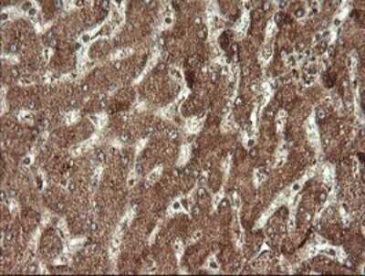 Immunohistochemistry: STK38L Antibody (OTI4D8) [NBP2-45983]