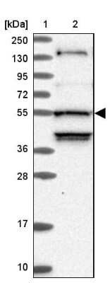 Western Blot: STK38L Antibody [NBP1-92454]