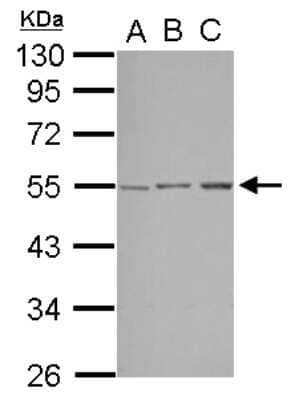 Western Blot: STK38L Antibody [NBP2-20518]