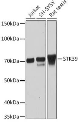 Western Blot: STK39 Antibody (0D9L5) [NBP3-16104]