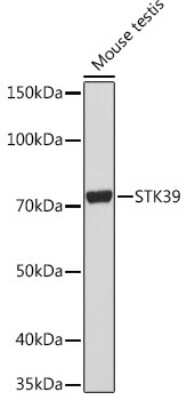 Western Blot: STK39 Antibody (0D9L5) [NBP3-16104]