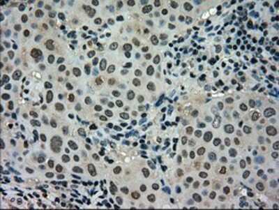 Immunohistochemistry-Paraffin: STK39 Antibody (OTI4E3) [NBP1-48021]