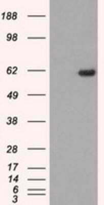 Western Blot: STK39 Antibody (OTI4E3) [NBP1-48021]