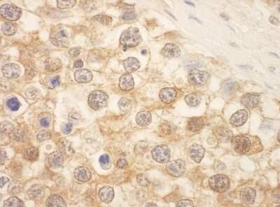 Immunohistochemistry: STK39 Antibody [NBP1-30112]