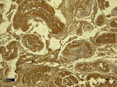 Immunohistochemistry: STK39 Antibody [NBP1-51955]