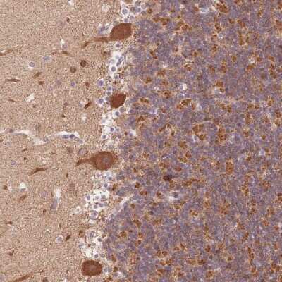 Immunohistochemistry: STK39 Antibody [NBP2-49373]