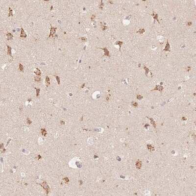 Immunohistochemistry-Paraffin: STK39 Antibody [NBP2-49347]