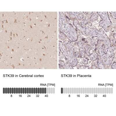 Immunohistochemistry-Paraffin: STK39 Antibody [NBP2-49347]