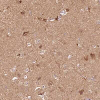 Immunohistochemistry-Paraffin: STK39 Antibody [NBP2-49373]
