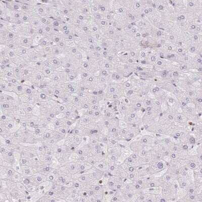 Immunohistochemistry-Paraffin: STK39 Antibody [NBP2-49373]