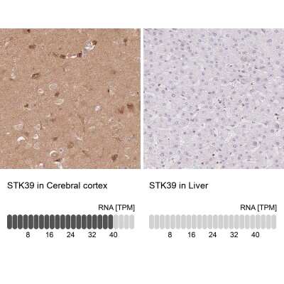 Immunohistochemistry-Paraffin: STK39 Antibody [NBP2-49373]