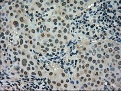 Immunohistochemistry: STK39 Antibody (OTI4E3) - Azide and BSA Free [NBP2-74406]