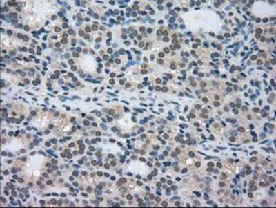 Immunohistochemistry: STK39 Antibody (OTI4E3) - Azide and BSA Free [NBP2-74406]