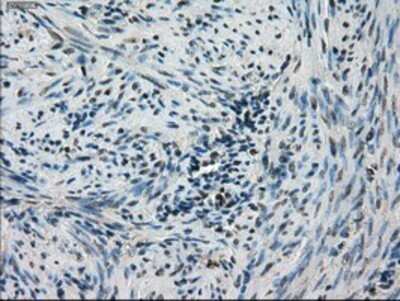 Immunohistochemistry: STK39 Antibody (OTI4E3) - Azide and BSA Free [NBP2-74406]