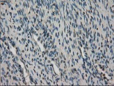 Immunohistochemistry: STK39 Antibody (OTI4E3) - Azide and BSA Free [NBP2-74406]