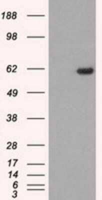 Western Blot: STK39 Antibody (OTI4E3)Azide and BSA Free [NBP2-74406]