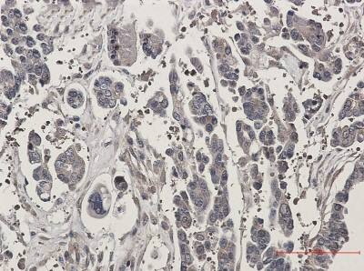 Immunohistochemistry-Paraffin: STK39 Antibody (S06-2B0) [NBP3-20003]