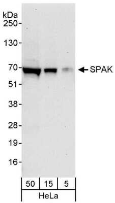 Western Blot: STK39 Antibody [NBP1-30112]