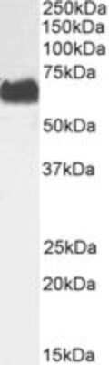 Western Blot: STK39 Antibody [NBP1-51955]