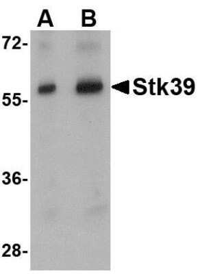 Western Blot: STK39 AntibodyBSA Free [NBP1-76957]