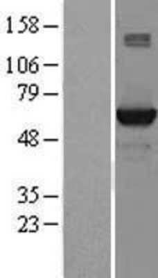 Western Blot: STK39 Overexpression Lysate [NBL1-16554]