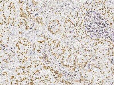 Immunohistochemistry-Paraffin: STK4 Antibody (025) [NBP2-89912]