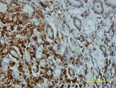 Immunohistochemistry-Paraffin: STK4 Antibody (1D7-8A10) [H00006789-M01]