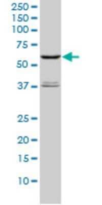 Western Blot: STK4 Antibody (1D7-8A10) [H00006789-M01]