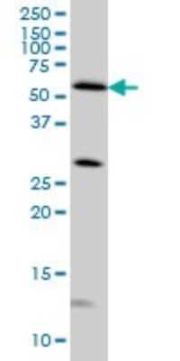 Western Blot: STK4 Antibody (4F4) [H00006789-M02]