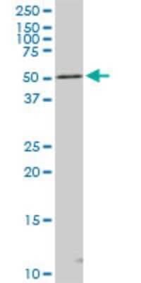 Western Blot: STK4 Antibody (4F4) [H00006789-M02]