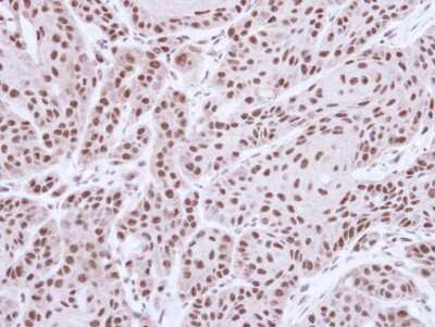 Immunohistochemistry-Paraffin: STK4 Antibody [NBP1-31233]