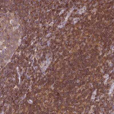 Immunohistochemistry-Paraffin: STK4 Antibody [NBP1-82865]