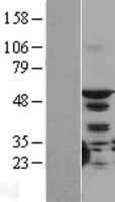 Western Blot: STK4 Overexpression Lysate [NBL1-16555]