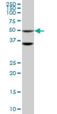 Western Blot: STK40 Antibody (4G3) [H00083931-M04]