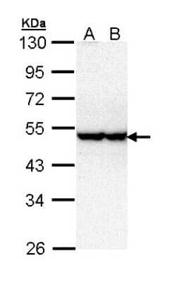 Western Blot: STK40 Antibody [NBP1-33391]