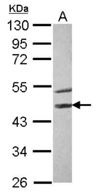 Western Blot: STK40 Antibody [NBP2-20519]