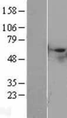 Western Blot: STK40 Overexpression Lysate [NBL1-16556]